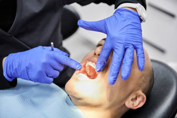 Best Emergency Denture Repair in St Marys, WV