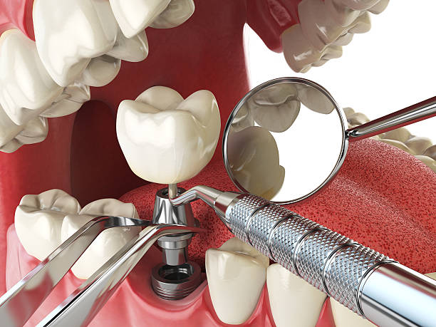 Best Same-Day Emergency Dental Services in St Marys, WV